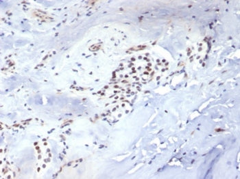 IHC staining of FFPE human parathyroid tissue with Brachyury antibody (clone TBXT/7711R). HIER: boil