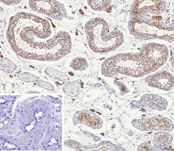 IHC staining of FFPE human testis tissue with Inhibin alpha chain antibody (clone INHA/9354). Inset: