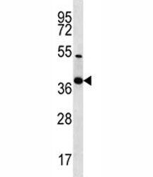 NKX2.2 Antibody
