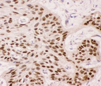p63 Antibody
