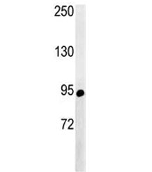 Western blot analysis of ABCF1 antibody and NCI-H460 lysate. Predicted molecular weight ~96 kDa.