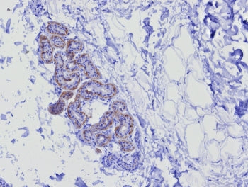 KRT17 Antibody / Cytokeratin 17