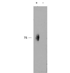 Western blot testing of immunoprecipitate from a lysate of human natural killer cells with (+) or wi