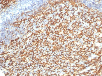 IHC staining of FFPE human tonsil tissue with CD21 antibody (clone CR2/7185R). HIER: boil tissue sec