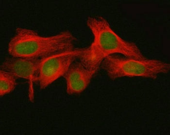Immunofluorescent staining of FFPE human HeLa cells with FBXO32 antibody (green) and Beta Tubulin mA