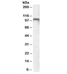 Western blot testing of human cerebellum lysate with GRM7 antibody at 0.5ug/ml. Predicted molecular 