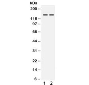 Western blot testing of 1) mouse skeletal muscle and 2) human HeLa lysate with PPP1R12A antibody. Ex