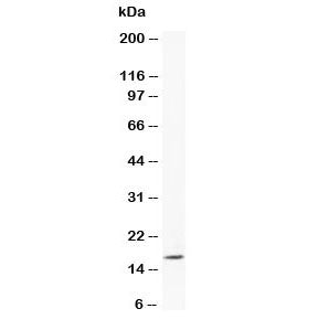 Western blot testing of Myoglobin antibody and human placenta tissue lysate. Predicted molecular wei