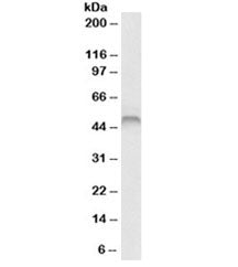 Fascin Antibody