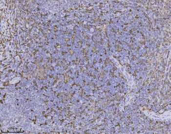 IHC staining of FFPE human tonsil tissue with AIF-1 antibody, HRP-secondary and DAB substrate. HIER: