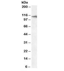 Western blot testing of human liver lysate with CLEC16A antibody at 2ug/ml. Predicted molecular weig