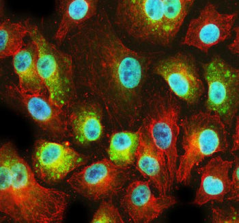 Immunofluorescent staining of PFDN2 using anti-PFDN2 antibody (green) and anti-Beta Tubulin antibody