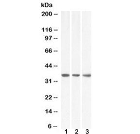 Western blot testing of 1) human HeLa, 2) human HepG2 and 3) mouse NIH3T3 lysate with MDH2 antibody 