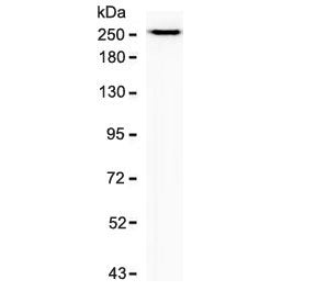Western blot testing of human PANC-1 cell lysate with recombinant SPTBN2 antibody (clone SCNB3-2R). 