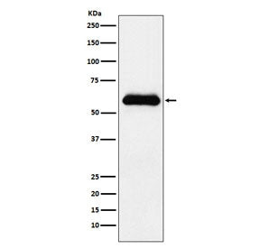 Western blot testing of human plasma lysate with SERPINA3 antibody. Expected molecular weight: 47-65