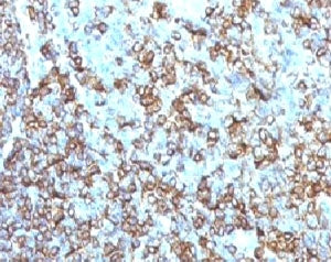 IHC testing of FFPE human tonsil and HLA-DRB1 antibody (clone MHDRb2). Staining of formalin-fixed ti