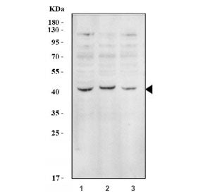 Western blot testing of human 1) HepG2, 2) 293T and 3) Raji cell lysate with EIF2B antibody. Expecte