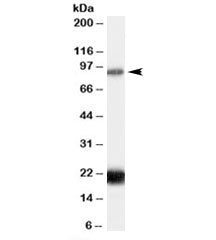 Western blot testing of human thyroid lysate with RASAL1 antibody at 0.3ug/ml. The expected ~90 kDa 