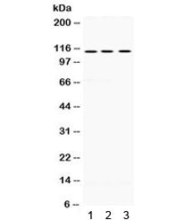 Western blot testing of 1) rat brain, 2) mouse brain and 3) human HeLa lysate with UNC5C antibody. P