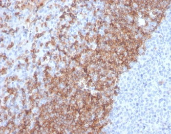 IHC staining of FFPE human tonsil tissue with IgD antibody (clone IGHD/2730R). HIER: boil tissue sec