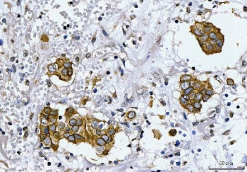 HER2 Antibody / ErbB2