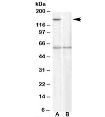 SIPA1 Antibody