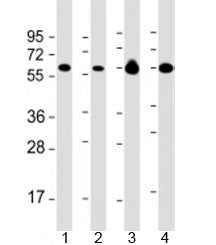 Western blot testing of 1) Daudi, 2) HL-60 cell lysate, 3) human brain and 4) mouse brain lysate wit
