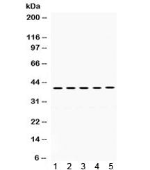 Western blot testing of human 1) A549, 2) HUT, 3) Jurkat, 4) SW620 and 5) MCF7 cell lysate with OSM 