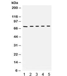 Bradykinin Antibody / Kininogen
