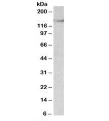 Western blot testing of mouse brain lysate with SYNGAP1 antibody at 0.03ug/ml. Predicted/observed mo