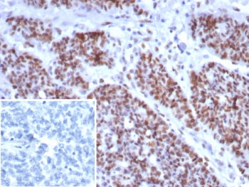 IHC staining of FFPE human small intestine tissue with recombinant MSH6 antibody (clone rMSH6/8337).