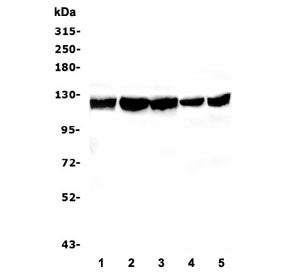 Western blot testing of human 1) HL-60, 2) HEK293, 3) MDA-MB-453, 4) Caco-2 and 5) PC-3 cell lysate 