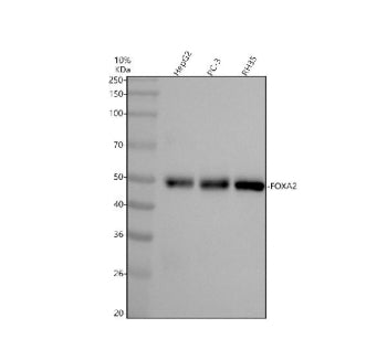 FOXA2 Antibody / Forkhead box protein A2, 100ul