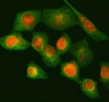 Immunofluorescent staining of NUP88 using anti-NUP88 antibody (red) and anti-Beta Tubulin antibody (
