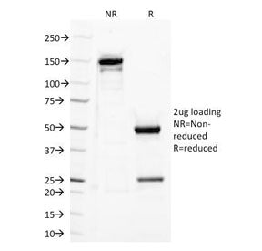 SDS-PAGE Analysis of Purified, BSA-Free TLR2 Antibody (clone TLR2/221). Confirmation of Integrity an