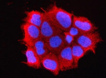 OMP Antibody / Olfactory marker protein
