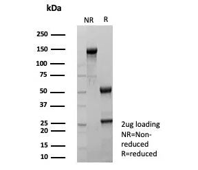 SDS-PAGE analysis of purified, BSA-free recombinant TFF1 antibody (clone rTFF1/9134) as confirmation