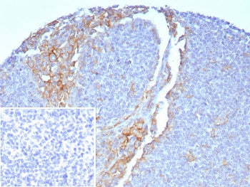 IHC staining of FFPE human tonsil with CD64 antibody (clone FCGR1A/7496) at 2ug/ml. Inset: PBS used 
