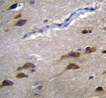 IHC testing of FFPE human brain tissue with GPR45 antibody. HIER: steam section in pH6 citrate buffe
