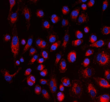 Immunofluorescent staining of FFPE human PC-3 cells with ALDH1A2 antibody (red) and DAPI nuclear sta