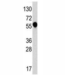 IL1R1 Antibody