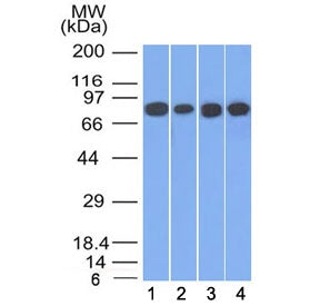 Western blot testing of human 1) HT20, 2) A549, 3) HEK293 and 4) A431 cell lysate with Plakoglobin a