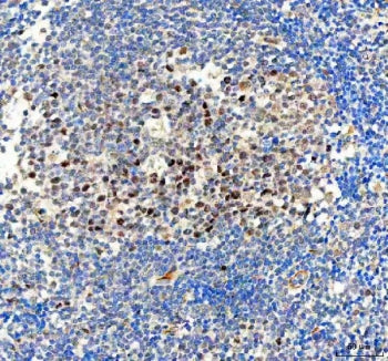 BAG1 Antibody