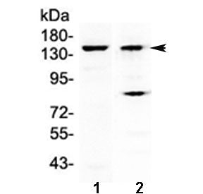 Western blot testing of 1) mouse liver and 2) human A431 lysate with FBXL11 antibody at 0.5ug/ml. Pr