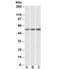 Western blot testing of A) HeLa, B) HepG2 and C) K562 cell lysate using HMGCS1 antibody at 1ug/ml. P