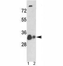 Western blot analysis of VDAC antibody and 1) human A375 cell line and 2) mouse heart tissue lysate.