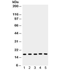Western blot testing of 1) rat lung, 2) mouse liver, 3) human A549, 4) PANC and 5) 293 lysate with C