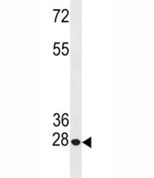 Bcl-2 Antibody