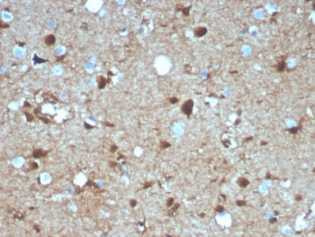 S100B Antibody