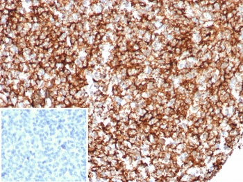IHC staining of FFPE human tonsil tissue with CD35 antibody (clone rCR1/8600). Inset: PBS used in pl